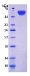 SDS-PAGE (CDH11-1538H).jpg